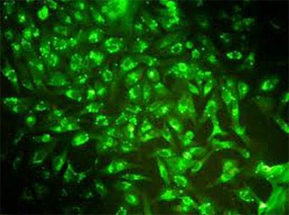 Fluorescent labeling reagent